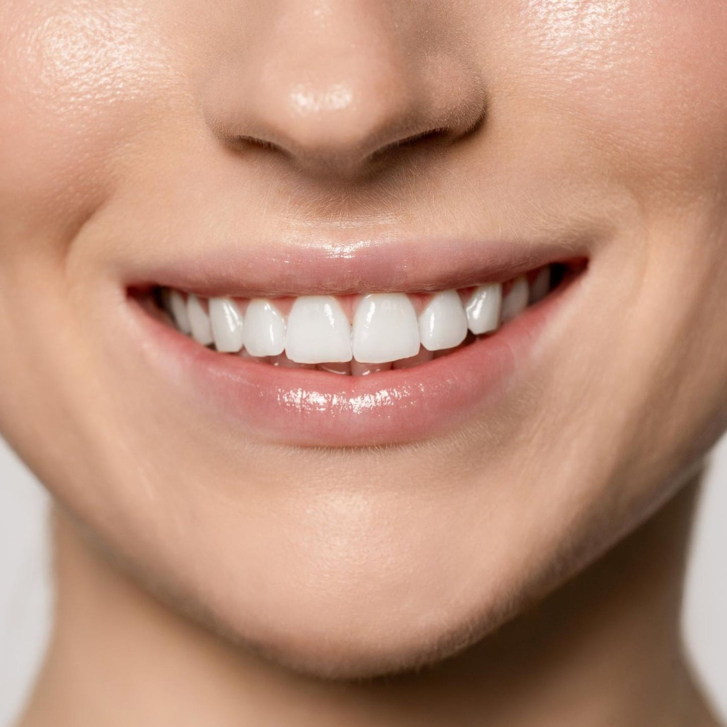 Close-up van een glimlach met wittere tanden door LucidBite whitening strips