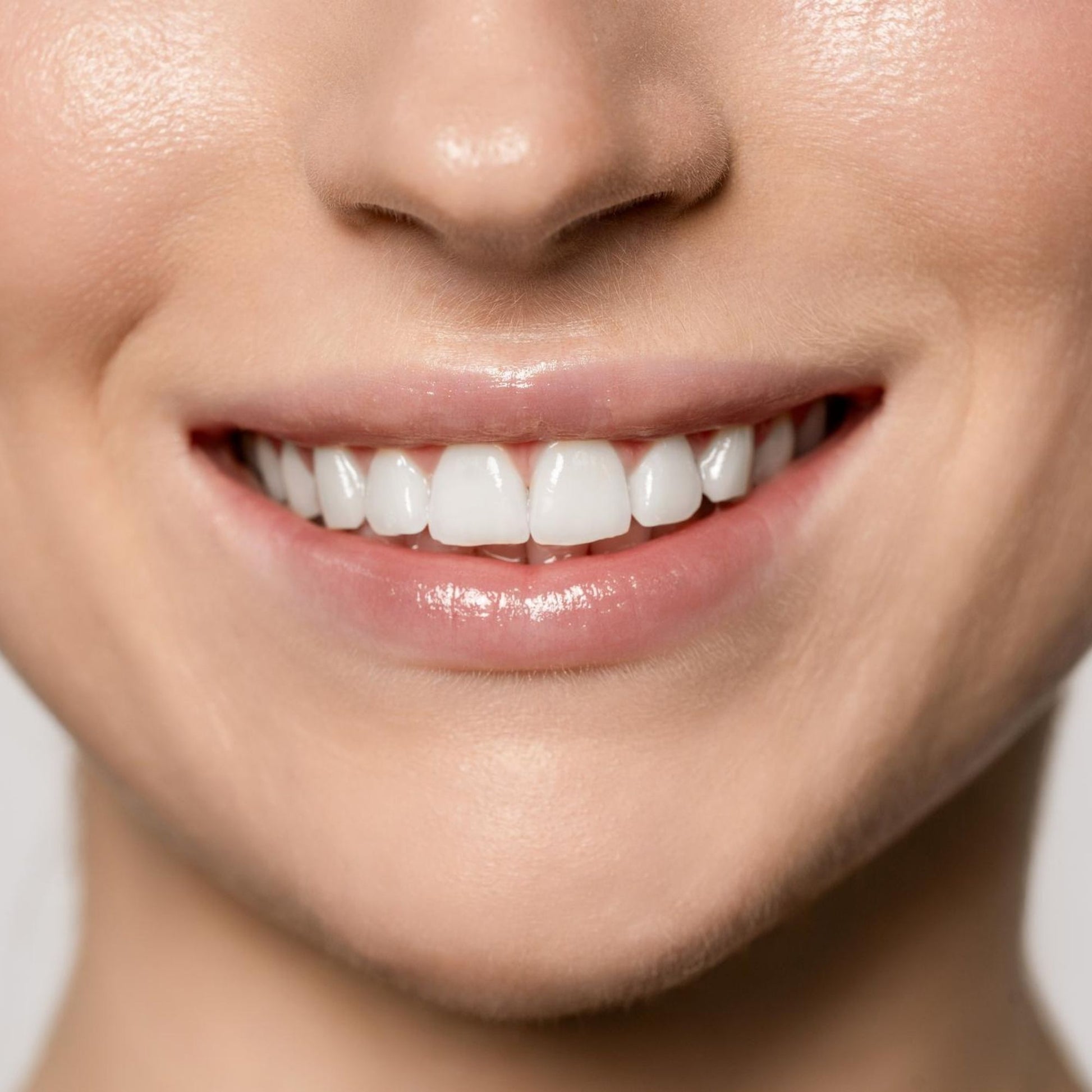 Close-up van een glimlach met wittere tanden door LucidBite whitening strips